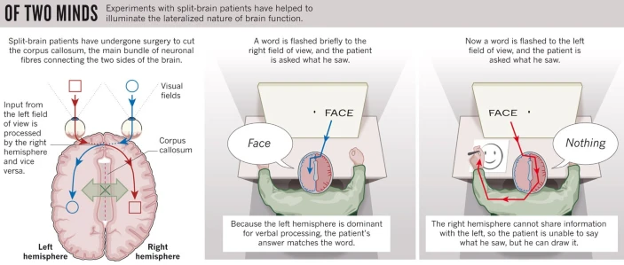 split brain diagram, courtesy of Nature, ISSN 1476-4687